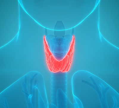 Anaplastic Thyroid Cancer - A Pipeline Analysis Report